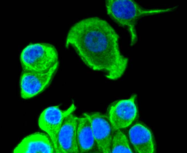 ICC staining of Cytokeratin 8 in A431 cells (green). Formalin fixed cells were permeabilized with 0.1% Triton X-100 in TBS for 10 minutes at room temperature and blocked with 1% Blocker BSA for 15 minutes at room temperature. Cells were probed with the primary antibody (ET1608-32, 1/50) for 1 hour at room temperature, washed with PBS. Alexa Fluor®488 Goat anti-Rabbit IgG was used as the secondary antibody at 1/1,000 dilution. The nuclear counter stain is DAPI (blue).