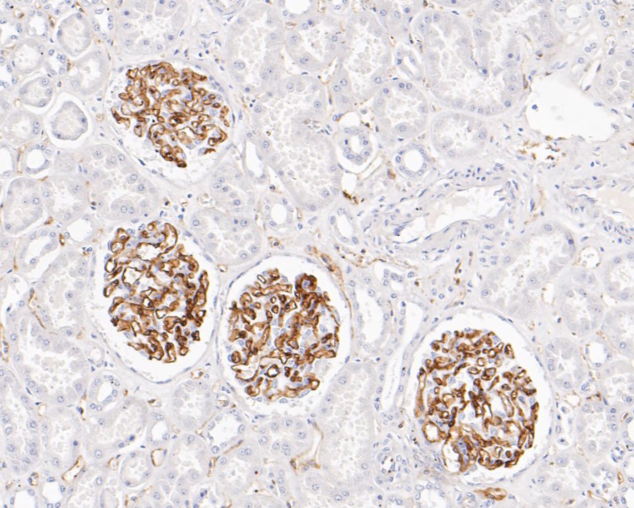 Immunohistochemical analysis of paraffin-embedded human kidney tissue with Rabbit anti-VEGF Receptor 2 antibody (ET1608-33) at 1/200 dilution.<br />
<br />
The section was pre-treated using heat mediated antigen retrieval with sodium citrate buffer (pH 6.0) for 2 minutes. The tissues were blocked in 1% BSA for 20 minutes at room temperature, washed with ddH2O and PBS, and then probed with the primary antibody (ET1608-33) at 1/200 dilution for 1 hour at room temperature. The detection was performed using an HRP conjugated compact polymer system. DAB was used as the chromogen. Tissues were counterstained with hematoxylin and mounted with DPX.