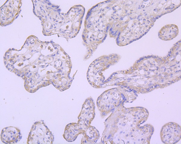 Immunohistochemical analysis of paraffin-embedded human pancreas tissue using anti-B Raf antibody. The section was pre-treated using heat mediated antigen retrieval with Tris-EDTA buffer (pH 8.0-8.4) for 20 minutes.The tissues were blocked in 5% BSA for 30 minutes at room temperature, washed with ddH2O and PBS, and then probed with the primary antibody (ET1608-36, 1/50) for 30 minutes at room temperature. The detection was performed using an HRP conjugated compact polymer system. DAB was used as the chromogen. Tissues were counterstained with hematoxylin and mounted with DPX.