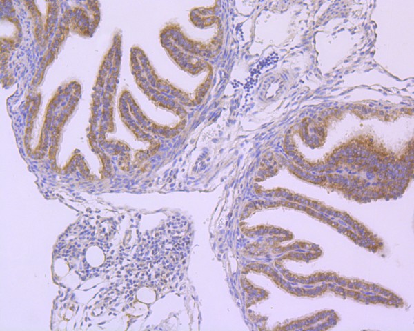 Immunohistochemical analysis of paraffin-embedded mouse brain tissue using anti-B Raf antibody. The section was pre-treated using heat mediated antigen retrieval with Tris-EDTA buffer (pH 8.0-8.4) for 20 minutes.The tissues were blocked in 5% BSA for 30 minutes at room temperature, washed with ddH2O and PBS, and then probed with the primary antibody (ET1608-36, 1/50) for 30 minutes at room temperature. The detection was performed using an HRP conjugated compact polymer system. DAB was used as the chromogen. Tissues were counterstained with hematoxylin and mounted with DPX.