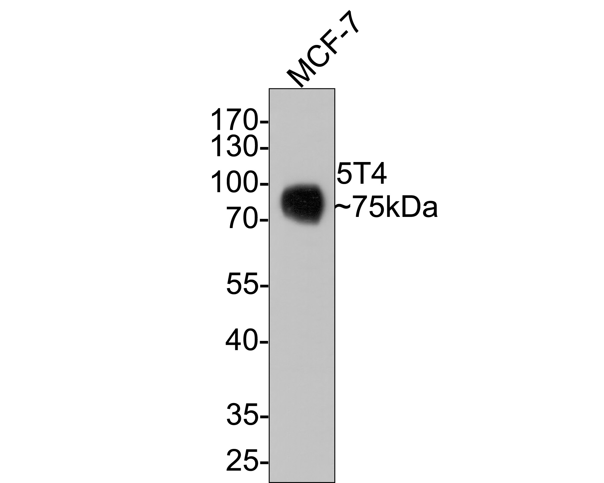 Western blot analysis of 5T4 on MCF-7 cell lysates with Rabbit anti-5T4 antibody (ET1608-37) at 1/500 dilution.<br />
<br />
Lysates/proteins at 10 µg/Lane.<br />
<br />
Predicted band size: 46 kDa<br />
Observed band size: 75 kDa<br />
<br />
Exposure time: 1 minute;<br />
<br />
10% SDS-PAGE gel.<br />
<br />
Proteins were transferred to a PVDF membrane and blocked with 5% NFDM/TBST for 1 hour at room temperature. The primary antibody (ET1608-37) at 1/500 dilution was used in 5% NFDM/TBST at room temperature for 2 hours. Goat Anti-Rabbit IgG - HRP Secondary Antibody (HA1001) at 1:300,000 dilution was used for 1 hour at room temperature.