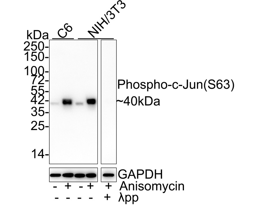 Western blot analysis of Phospho-c-Jun(S63) on different lysates with Rabbit anti-Phospho-c-Jun(S63) antibody (ET1608-4) at 1/500 dilution.<br />
<br />
Lane 1: U87MG cell lysate<br />
Lane 2: NIH/3T3 cell lysate<br />
Lane 3: 293T cell lysate<br />
<br />
Lysates/proteins at 10 µg/Lane.<br />
<br />
Predicted band size: 36 kDa<br />
Observed band size: 42 kDa<br />
<br />
Exposure time: 2 minutes;<br />
<br />
12% SDS-PAGE gel.<br />
<br />
Proteins were transferred to a PVDF membrane and blocked with 5% NFDM/TBST for 1 hour at room temperature. The primary antibody (ET1608-4) at 1/500 dilution was used in 5% NFDM/TBST at room temperature for 2 hours. Goat Anti-Rabbit IgG - HRP Secondary Antibody (HA1001) at 1:300,000 dilution was used for 1 hour at room temperature.
