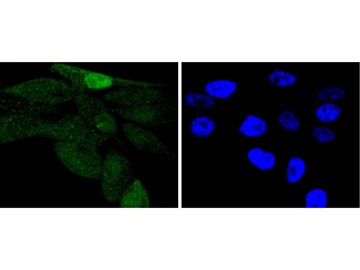 ICC staining of Phospho-c-Jun(S63) in PC-3M cells (green). Formalin fixed cells were permeabilized with 0.1% Triton X-100 in TBS for 10 minutes at room temperature and blocked with 1% Blocker BSA for 15 minutes at room temperature. Cells were probed with the primary antibody (ET1608-4, 1/50) for 1 hour at room temperature, washed with PBS. Alexa Fluor®488 Goat anti-Rabbit IgG was used as the secondary antibody at 1/1,000 dilution. The nuclear counter stain is DAPI (blue).
