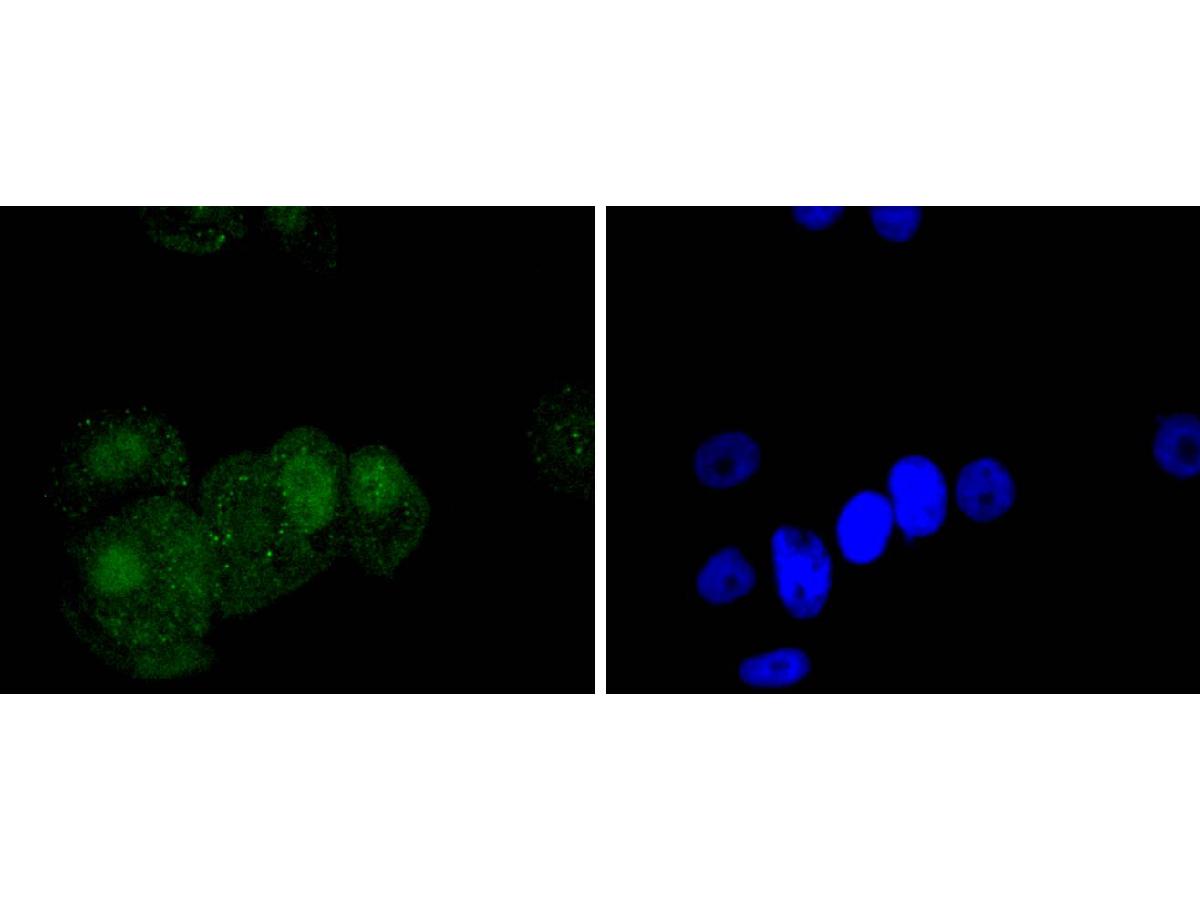 ICC staining of Phospho-c-Jun(S63) in A549 cells (green). Formalin fixed cells were permeabilized with 0.1% Triton X-100 in TBS for 10 minutes at room temperature and blocked with 1% Blocker BSA for 15 minutes at room temperature. Cells were probed with the primary antibody (ET1608-4, 1/50) for 1 hour at room temperature, washed with PBS. Alexa Fluor®488 Goat anti-Rabbit IgG was used as the secondary antibody at 1/1,000 dilution. The nuclear counter stain is DAPI (blue).