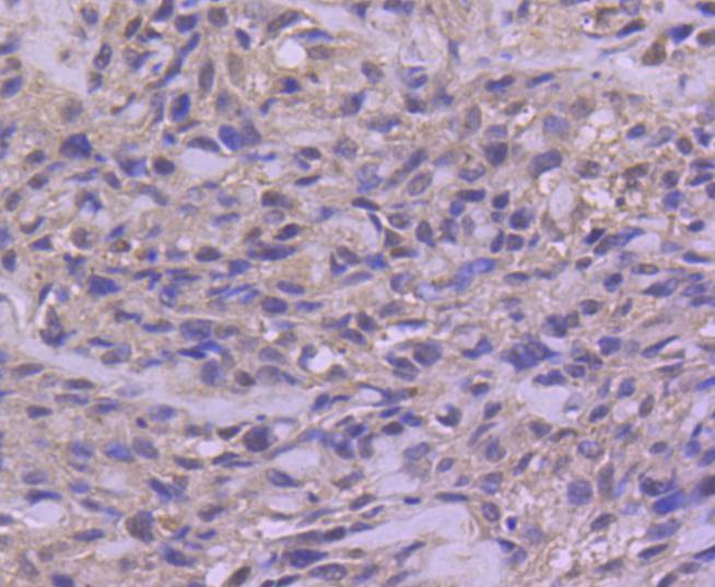 Immunohistochemical analysis of paraffin-embedded human tonsil tissue using anti-Phospho-c-Jun(S63) antibody. The section was pre-treated using heat mediated antigen retrieval with Tris-EDTA buffer (pH 8.0-8.4) for 20 minutes.The tissues were blocked in 5% BSA for 30 minutes at room temperature, washed with ddH2O and PBS, and then probed with the primary antibody (ET1608-4, 1/50) for 30 minutes at room temperature. The detection was performed using an HRP conjugated compact polymer system. DAB was used as the chromogen. Tissues were counterstained with hematoxylin and mounted with DPX.