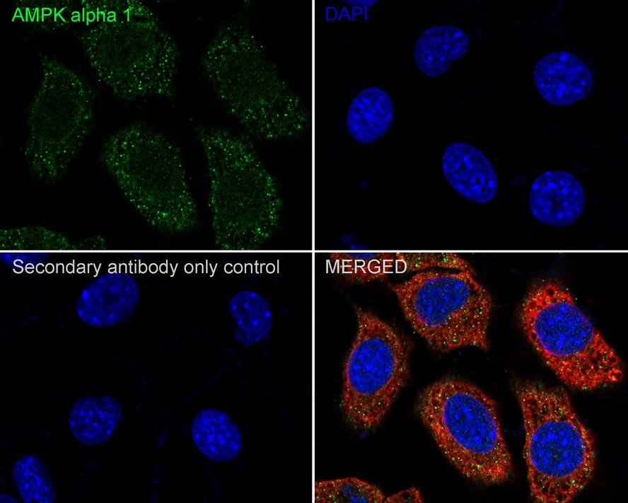 Immunofluorescence analysis of frozen mouse hippocampus tissue labeling AMPK alpha 1 with Rabbit anti-AMPK alpha 1 antibody (ET1608-40).<br />
<br />
The tissues were blocked in 3% BSA for 30 minutes at room temperature, washed with PBS, and then probed with the primary antibody (ET1608-40, green) at 1/100 dilution overnight at 4℃, washed with PBS. Goat Anti-Rabbit IgG H&L (Alexa Fluor® 488) was used as the secondary antibody at 1/200 dilution. Nuclei were counterstained with DAPI (blue). Image acquisition was performed with KFBIO KF-FL-400 Scanner.