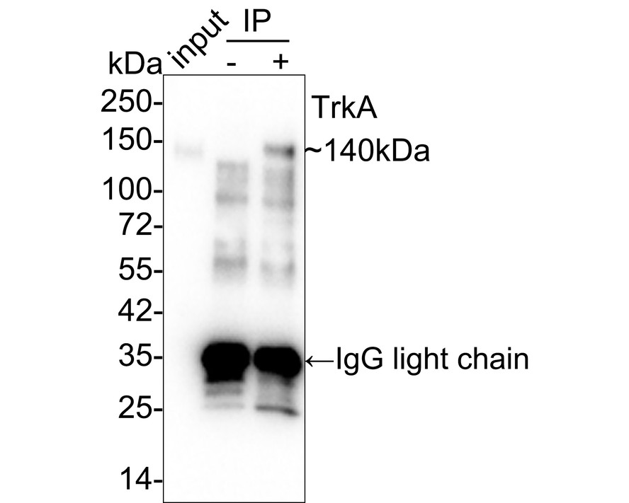 Western blot analysis of TrkA on N2A cell lysates. Proteins were transferred to a PVDF membrane and blocked with 5% BSA in PBS for 1 hour at room temperature. The primary antibody (ET1608-44, 1/500) was used in 5% BSA at room temperature for 2 hours. Goat Anti-Rabbit IgG - HRP Secondary Antibody (HA1001) at 1:200,000 dilution was used for 1 hour at room temperature.
