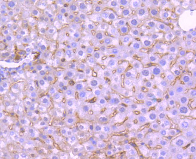 ICC staining of TrkA in SH-SY5Y cells (green). Formalin fixed cells were permeabilized with 0.1% Triton X-100 in TBS for 10 minutes at room temperature and blocked with 10% negative goat serum for 15 minutes at room temperature. Cells were probed with the primary antibody (ET1608-44, 1/50) for 1 hour at room temperature, washed with PBS. Alexa Fluor®488 conjugate-Goat anti-Rabbit IgG was used as the secondary antibody at 1/1,000 dilution. The nuclear counter stain is DAPI (blue).