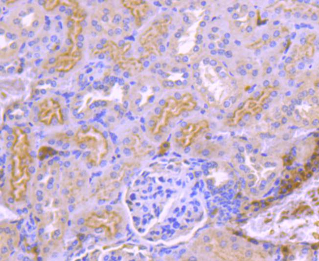 Immunohistochemical analysis of paraffin-embedded mouse liver tissue using anti-TrkA antibody. The section was pre-treated using heat mediated antigen retrieval with Tris-EDTA buffer (pH 9.0) for 20 minutes.The tissues were blocked in 1% BSA for 30 minutes at room temperature, washed with ddH2O and PBS, and then probed with the primary antibody (ET1608-44, 1/50) for 30 minutes at room temperature. The detection was performed using an HRP conjugated compact polymer system. DAB was used as the chromogen. Tissues were counterstained with hematoxylin and mounted with DPX.