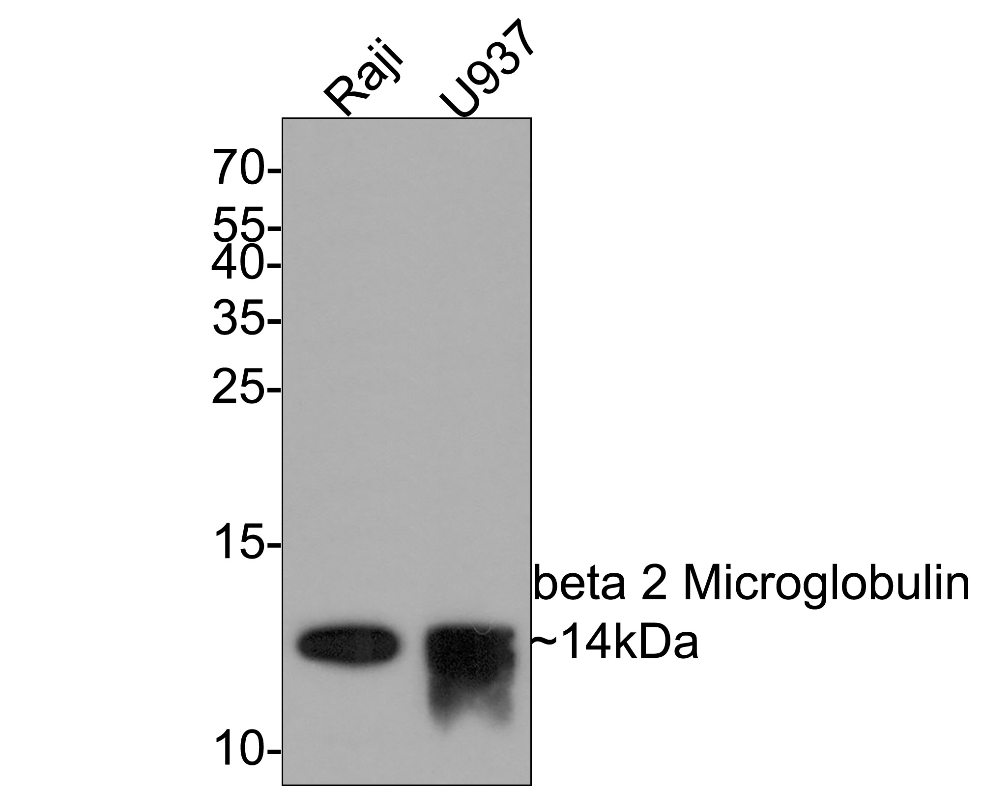 Western blot analysis of beta 2 Microglobulin on different lysates with Rabbit anti-beta 2 Microglobulin antibody (ET1608-45) at 1/500 dilution.<br />
<br />
Lane 1: Raji cell lysate<br />
Lane 2: U937 cell lysate<br />
<br />
Lysates/proteins at 10 µg/Lane.<br />
<br />
Predicted band size: 14 kDa<br />
Observed band size: 14 kDa<br />
<br />
Exposure time: 2 minutes;<br />
<br />
15% SDS-PAGE gel.<br />
<br />
Proteins were transferred to a PVDF membrane and blocked with 5% NFDM/TBST for 1 hour at room temperature. The primary antibody (ET1608-45) at 1/500 dilution was used in 5% NFDM/TBST at room temperature for 2 hours. Goat Anti-Rabbit IgG - HRP Secondary Antibody (HA1001) at 1:300,000 dilution was used for 1 hour at room temperature.