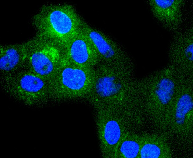 ICC staining of beta 2 Microglobulin in A431 cells (green). Formalin fixed cells were permeabilized with 0.1% Triton X-100 in TBS for 10 minutes at room temperature and blocked with 10% negative goat serum for 15 minutes at room temperature. Cells were probed with the primary antibody (ET1608-45, 1/50) for 1 hour at room temperature, washed with PBS. Alexa Fluor®488 conjugate-Goat anti-Rabbit IgG was used as the secondary antibody at 1/1,000 dilution. The nuclear counter stain is DAPI (blue).