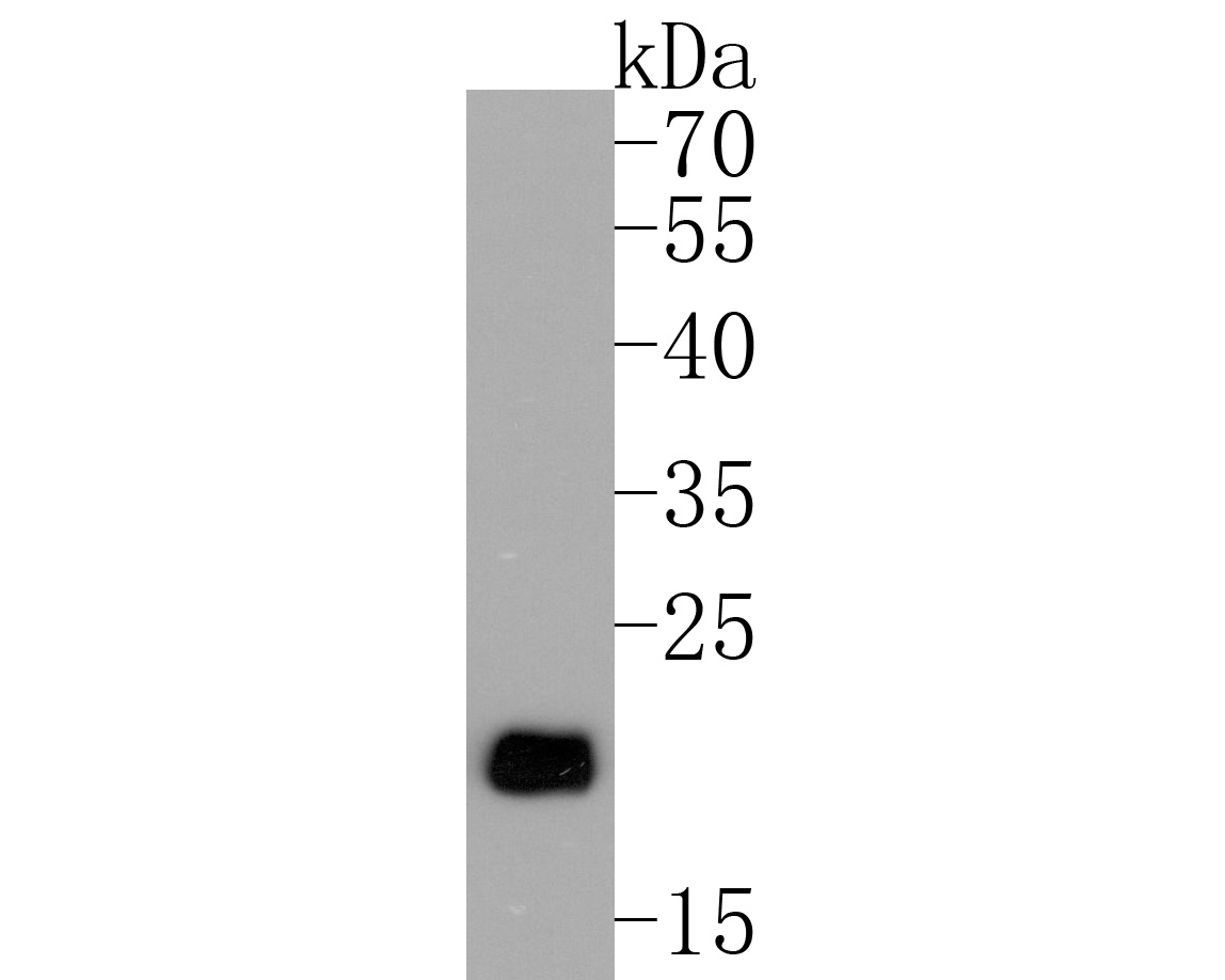 Sıçan beyin dokusu lizatları üzerinde CD90'ın Western blot analizi.  Proteinler bir PVDF membranına aktarıldı ve oda sıcaklığında 1 saat boyunca PBS içinde %5 BSA ile bloke edildi.  Primer antikor (ET1608-46, 1/500), 2 saat boyunca oda sıcaklığında %5 BSA içinde kullanıldı.  1:200.000 seyreltmede Keçi Anti-Rabbit IgG - HRP İkincil Antikoru (HA1001) oda sıcaklığında 1 saat kullanıldı.