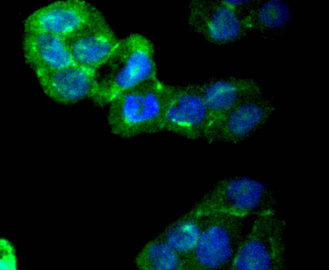 ICC staining of CaMKⅡ in Hela cells (green). Formalin fixed cells were permeabilized with 0.1% Triton X-100 in TBS for 10 minutes at room temperature and blocked with 1% Blocker BSA for 15 minutes at room temperature. Cells were probed with the primary antibody (ET1608-47, 1/50) for 1 hour at room temperature, washed with PBS. Alexa Fluor®488 Goat anti-Rabbit IgG was used as the secondary antibody at 1/1,000 dilution. The nuclear counter stain is DAPI (blue).
