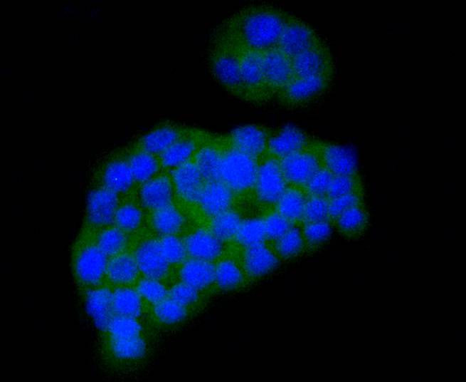 ICC staining of CaMKⅡ in PC-12 cells (green). Formalin fixed cells were permeabilized with 0.1% Triton X-100 in TBS for 10 minutes at room temperature and blocked with 1% Blocker BSA for 15 minutes at room temperature. Cells were probed with the primary antibody (ET1608-47, 1/50) for 1 hour at room temperature, washed with PBS. Alexa Fluor®488 Goat anti-Rabbit IgG was used as the secondary antibody at 1/1,000 dilution. The nuclear counter stain is DAPI (blue).