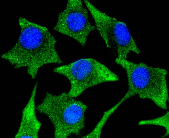 ICC staining of CaMKⅡ in SHG-44 cells (green). Formalin fixed cells were permeabilized with 0.1% Triton X-100 in TBS for 10 minutes at room temperature and blocked with 1% Blocker BSA for 15 minutes at room temperature. Cells were probed with the primary antibody (ET1608-47, 1/50) for 1 hour at room temperature, washed with PBS. Alexa Fluor®488 Goat anti-Rabbit IgG was used as the secondary antibody at 1/1,000 dilution. The nuclear counter stain is DAPI (blue).
