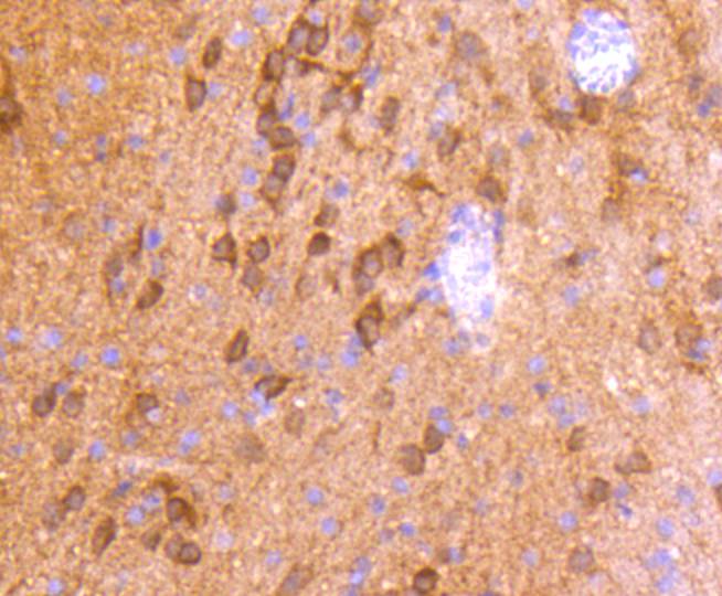 Immunohistochemical analysis of paraffin-embedded rat brain tissue using anti-CaMKⅡ antibody. The section was pre-treated using heat mediated antigen retrieval with Tris-EDTA buffer (pH 8.0-8.4) for 20 minutes.The tissues were blocked in 5% BSA for 30 minutes at room temperature, washed with ddH2O and PBS, and then probed with the primary antibody (ET1608-47, 1/50) for 30 minutes at room temperature. The detection was performed using an HRP conjugated compact polymer system. DAB was used as the chromogen. Tissues were counterstained with hematoxylin and mounted with DPX.