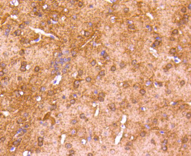 Immunohistochemical analysis of paraffin-embedded mouse brain tissue using anti-CaMKⅡ antibody. The section was pre-treated using heat mediated antigen retrieval with Tris-EDTA buffer (pH 8.0-8.4) for 20 minutes.The tissues were blocked in 5% BSA for 30 minutes at room temperature, washed with ddH2O and PBS, and then probed with the primary antibody (ET1608-47, 1/50) for 30 minutes at room temperature. The detection was performed using an HRP conjugated compact polymer system. DAB was used as the chromogen. Tissues were counterstained with hematoxylin and mounted with DPX.