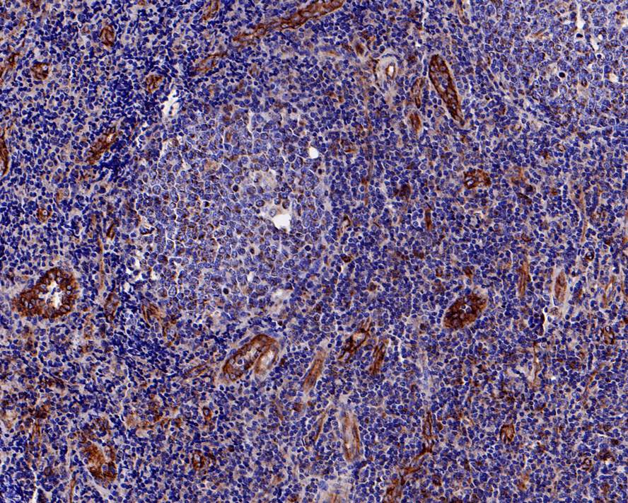 Immunohistochemical analysis of paraffin-embedded human kidney tissue using anti-CD31 antibody. The section was pre-treated using heat mediated antigen retrieval with Tris-EDTA buffer (pH 8.0-8.4) for 20 minutes.The tissues were blocked in 5% BSA for 30 minutes at room temperature, washed with ddH2O and PBS, and then probed with the primary antibody (ET1608-48, 1/50) for 30 minutes at room temperature. The detection was performed using an HRP conjugated compact polymer system. DAB was used as the chromogen. Tissues were counterstained with hematoxylin and mounted with DPX.