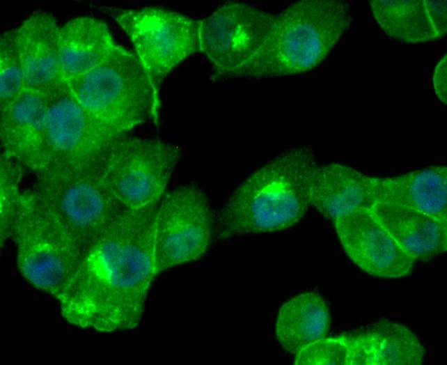 ICC staining of Cathepsin D in PANC-1 cells (green). Formalin fixed cells were permeabilized with 0.1% Triton X-100 in TBS for 10 minutes at room temperature and blocked with 1% Blocker BSA for 15 minutes at room temperature. Cells were probed with the primary antibody (ET1608-49, 1/50) for 1 hour at room temperature, washed with PBS. Alexa Fluor®488 Goat anti-Rabbit IgG was used as the secondary antibody at 1/1,000 dilution. The nuclear counter stain is DAPI (blue).