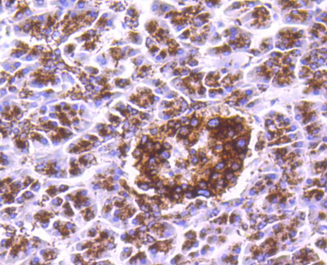 Immunohistochemical analysis of paraffin-embedded human pancreas tissue using anti-Cathepsin D antibody. The section was pre-treated using heat mediated antigen retrieval with Tris-EDTA buffer (pH 8.0-8.4) for 20 minutes.The tissues were blocked in 5% BSA for 30 minutes at room temperature, washed with ddH2O and PBS, and then probed with the primary antibody (ET1608-49, 1/50) for 30 minutes at room temperature. The detection was performed using an HRP conjugated compact polymer system. DAB was used as the chromogen. Tissues were counterstained with hematoxylin and mounted with DPX.