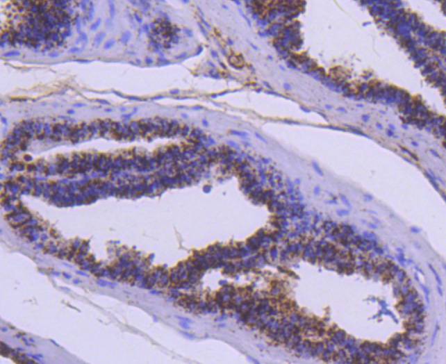 Immunohistochemical analysis of paraffin-embedded mouse prostate tissue using anti-Cathepsin D antibody. The section was pre-treated using heat mediated antigen retrieval with Tris-EDTA buffer (pH 8.0-8.4) for 20 minutes.The tissues were blocked in 5% BSA for 30 minutes at room temperature, washed with ddH2O and PBS, and then probed with the primary antibody (ET1608-49, 1/50) for 30 minutes at room temperature. The detection was performed using an HRP conjugated compact polymer system. DAB was used as the chromogen. Tissues were counterstained with hematoxylin and mounted with DPX.