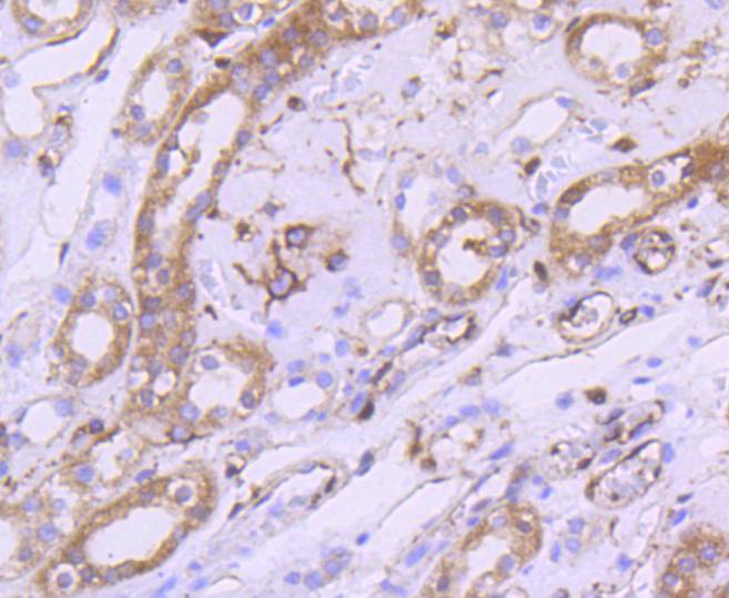 Immunohistochemical analysis of paraffin-embedded mouse kidney tissue using anti-mTOR antibody. The section was pre-treated using heat mediated antigen retrieval with Tris-EDTA buffer (pH 8.0-8.4) for 20 minutes.The tissues were blocked in 5% BSA for 30 minutes at room temperature, washed with ddH2O and PBS, and then probed with the primary antibody (ET1608-5, 1/50) for 30 minutes at room temperature. The detection was performed using an HRP conjugated compact polymer system. DAB was used as the chromogen. Tissues were counterstained with hematoxylin and mounted with DPX.