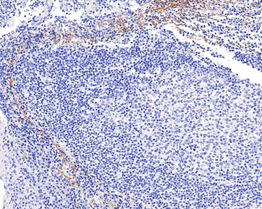 Immunohistochemical analysis of paraffin-embedded human tonsil tissue with Rabbit anti-Tenascin C antibody (ET1608-50) at 1/400 dilution.<br />
<br />
The section was pre-treated using heat mediated antigen retrieval with Tris-EDTA buffer (pH 9.0) for 20 minutes. The tissues were blocked in 1% BSA for 20 minutes at room temperature, washed with ddH2O and PBS, and then probed with the primary antibody (ET1608-50) at 1/400 dilution for 1 hour at room temperature. The detection was performed using an HRP conjugated compact polymer system. DAB was used as the chromogen. Tissues were counterstained with hematoxylin and mounted with DPX.
