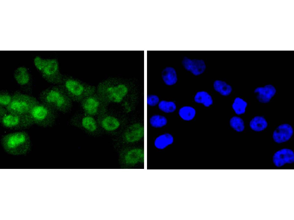 ICC staining of Phospho-RSK1 p90(T359+S363) in A431 cells (green). Formalin fixed cells were permeabilized with 0.1% Triton X-100 in TBS for 10 minutes at room temperature and blocked with 10% negative goat serum for 15 minutes at room temperature. Cells were probed with the primary antibody (ET1608-53, 1/50) for 1 hour at room temperature, washed with PBS. Alexa Fluor®488 conjugate-Goat anti-Rabbit IgG was used as the secondary antibody at 1/1,000 dilution. The nuclear counter stain is DAPI (blue).
