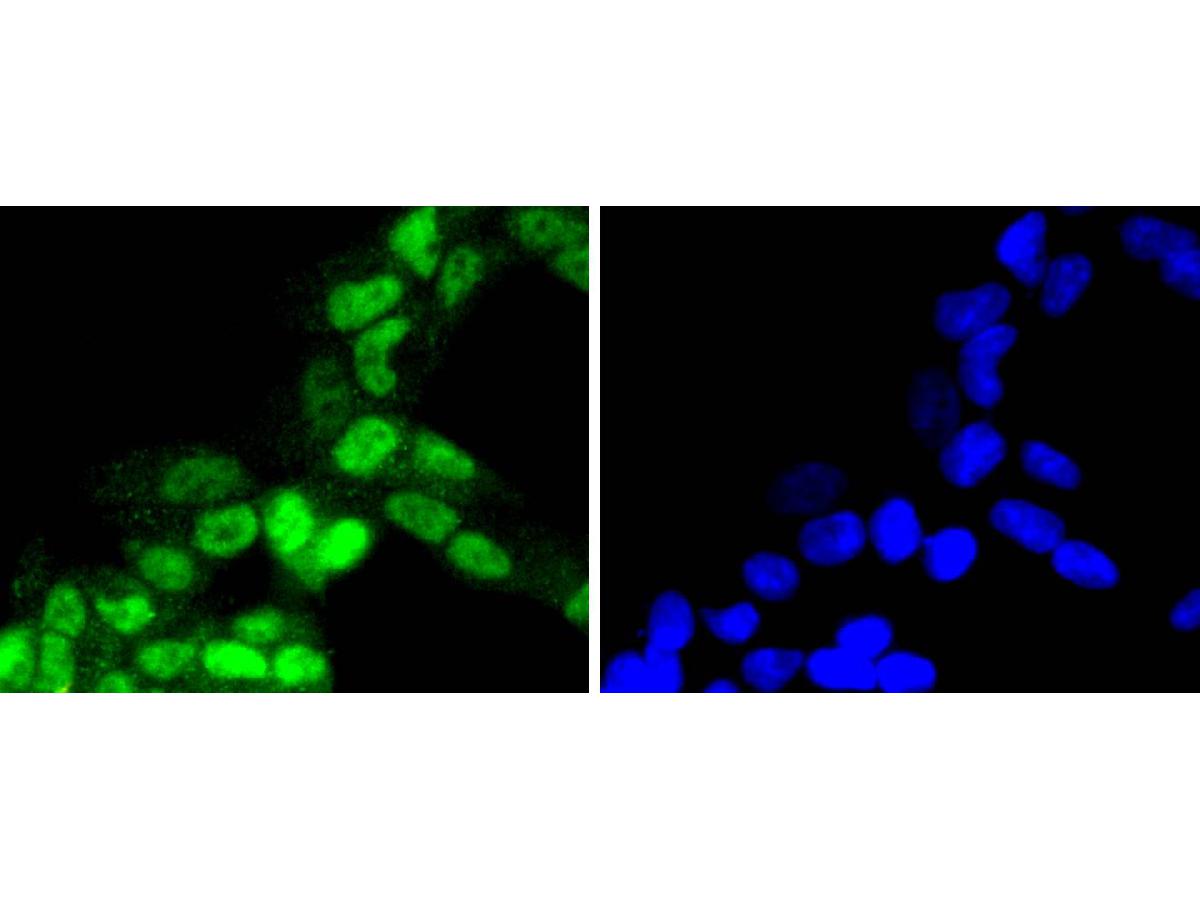 ICC staining of Phospho-RSK1 p90(T359+S363) in 293 cells (green). Formalin fixed cells were permeabilized with 0.1% Triton X-100 in TBS for 10 minutes at room temperature and blocked with 10% negative goat serum for 15 minutes at room temperature. Cells were probed with the primary antibody (ET1608-53, 1/50) for 1 hour at room temperature, washed with PBS. Alexa Fluor®488 conjugate-Goat anti-Rabbit IgG was used as the secondary antibody at 1/1,000 dilution. The nuclear counter stain is DAPI (blue).