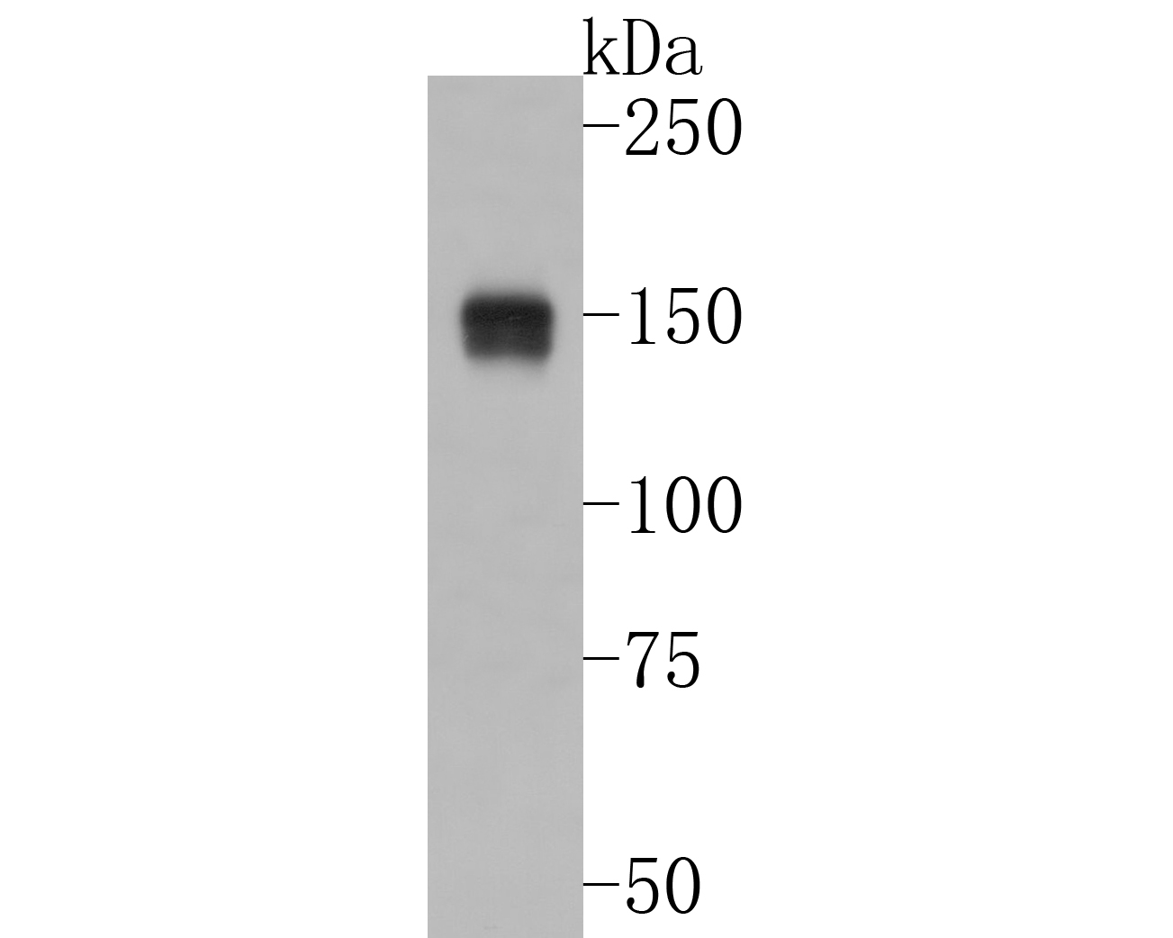 Western blot analysis of ASK1 on 293 cell lysates. Proteins were transferred to a PVDF membrane and blocked with 5% BSA in PBS for 1 hour at room temperature. The primary antibody (ET1608-54, 1/500) was used in 5% BSA at room temperature for 2 hours. Goat Anti-Rabbit IgG - HRP Secondary Antibody (HA1001) at 1:5,000 dilution was used for 1 hour at room temperature.
