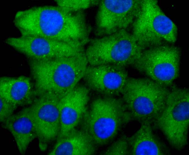 ICC staining of ASK1 in A549 cells (green). Formalin fixed cells were permeabilized with 0.1% Triton X-100 in TBS for 10 minutes at room temperature and blocked with 1% Blocker BSA for 15 minutes at room temperature. Cells were probed with the primary antibody (ET1608-54, 1/50) for 1 hour at room temperature, washed with PBS. Alexa Fluor®488 Goat anti-Rabbit IgG was used as the secondary antibody at 1/1,000 dilution. The nuclear counter stain is DAPI (blue).