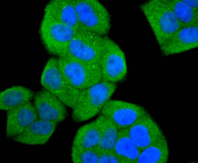 ICC staining of ASK1 in Hela cells (green). Formalin fixed cells were permeabilized with 0.1% Triton X-100 in TBS for 10 minutes at room temperature and blocked with 1% Blocker BSA for 15 minutes at room temperature. Cells were probed with the primary antibody (ET1608-54, 1/50) for 1 hour at room temperature, washed with PBS. Alexa Fluor®488 Goat anti-Rabbit IgG was used as the secondary antibody at 1/1,000 dilution. The nuclear counter stain is DAPI (blue).