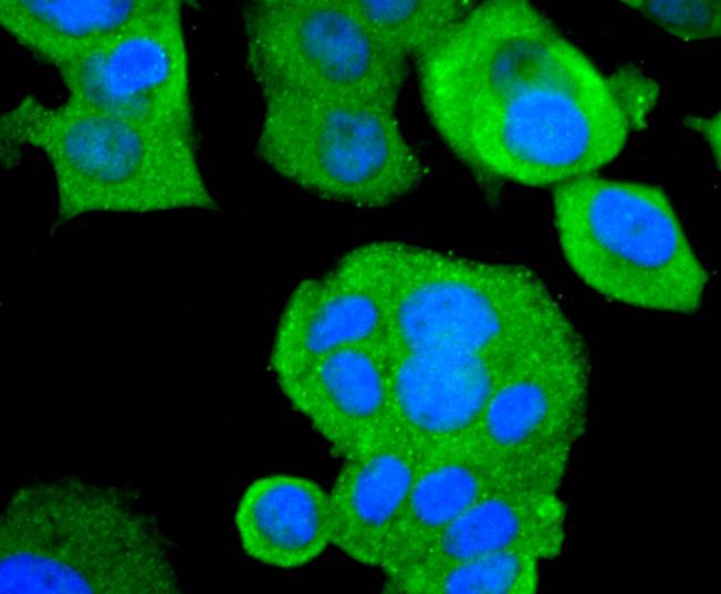 ICC staining of ASK1 in MCF-7 cells (green). Formalin fixed cells were permeabilized with 0.1% Triton X-100 in TBS for 10 minutes at room temperature and blocked with 1% Blocker BSA for 15 minutes at room temperature. Cells were probed with the primary antibody (ET1608-54, 1/50) for 1 hour at room temperature, washed with PBS. Alexa Fluor®488 Goat anti-Rabbit IgG was used as the secondary antibody at 1/1,000 dilution. The nuclear counter stain is DAPI (blue).