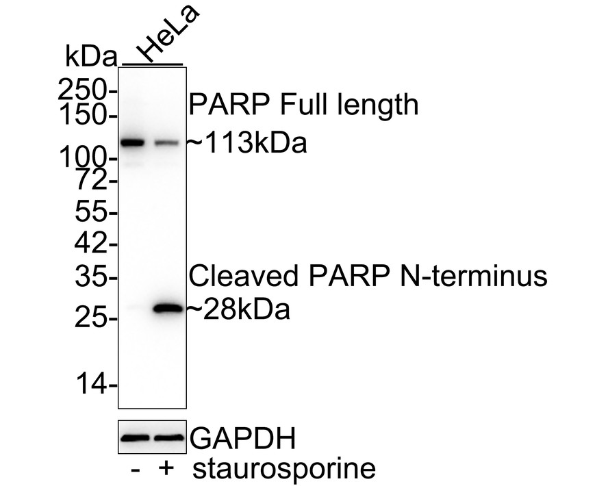 All lanes: Western blot analysis of PARP with anti-PARP antibody[SU03-68]  (ET1608-56) at 1:500 dilution.<br />
Lane 1/2: Wild-type Hela whole cell lysate (10 µg).<br />
Lane 3/4: PARP knockdown Hela whole cell lysate (10 µg).<br />
<br />
ET1608-56 was shown to specifically react with PARP in wild-type Hela cells. Weakened bands were observed when PARP knockdown samples were tested. Wild-type and PARP knockdown samples were subjected to SDS-PAGE. Proteins were transferred to a PVDF membrane and blocked with 5% NFDM in TBST for 1 hour at room temperature. The primary antibody (ET1608-56, 1/500) was used in 5% BSA at room temperature for 2 hours. Goat Anti-Rabbit IgG-HRP Secondary Antibody (HA1001) at 1:200,000 dilution was used for 1 hour at room temperature.