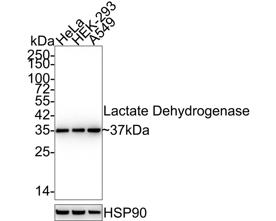 Western blot analysis of Lactate Dehydrogenase on different lysates with Rabbit anti-Lactate Dehydrogenase antibody (ET1608-57) at 1/1,000 dilution.<br />
<br />
Lane 1: Hela cell lysate<br />
Lane 2: A549 cell lysate<br />
Lane 3: MCF-7 cell lysate<br />
<br />
Lysates/proteins at 10 µg/Lane.<br />
<br />
Predicted band size: 37 kDa<br />
Observed band size: 37 kDa<br />
<br />
Exposure time: 1 minute;<br />
<br />
10% SDS-PAGE gel.<br />
<br />
Proteins were transferred to a PVDF membrane and blocked with 5% NFDM/TBST for 1 hour at room temperature. The primary antibody (ET1608-57) at 1/1,000 dilution was used in 5% NFDM/TBST at room temperature for 2 hours. Goat Anti-Rabbit IgG - HRP Secondary Antibody (HA1001) at 1:300,000 dilution was used for 1 hour at room temperature.