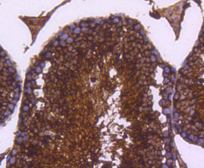 Immunohistochemical analysis of paraffin-embedded mouse skeletal muscle tissue using anti-Lactate Dehydrogenase antibody. The section was pre-treated using heat mediated antigen retrieval with Tris-EDTA buffer (pH 9.0) for 20 minutes.The tissues were blocked in 5% BSA for 30 minutes at room temperature, washed with ddH2O and PBS, and then probed with the primary antibody (ET1608-57, 1/50) for 30 minutes at room temperature. The detection was performed using an HRP conjugated compact polymer system. DAB was used as the chromogen. Tissues were counterstained with hematoxylin and mounted with DPX.