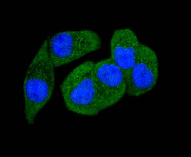 ICC staining of Phospho-PAK1(S144)+PAK2(S141)+PAK3(S139) in Hela cells (green). Formalin fixed cells were permeabilized with 0.1% Triton X-100 in TBS for 10 minutes at room temperature and blocked with 1% Blocker BSA for 15 minutes at room temperature. Cells were probed with the primary antibody (ET1608-58, 1/50) for 1 hour at room temperature, washed with PBS. Alexa Fluor®488 Goat anti-Rabbit IgG was used as the secondary antibody at 1/1,000 dilution. The nuclear counter stain is DAPI (blue).