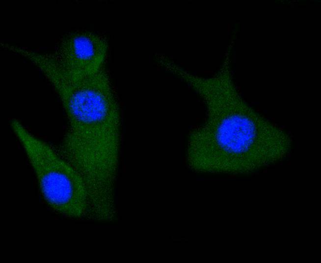 ICC staining of Phospho-PAK1(S144)+PAK2(S141)+PAK3(S139) in NIH/3T3 cells (green). Formalin fixed cells were permeabilized with 0.1% Triton X-100 in TBS for 10 minutes at room temperature and blocked with 1% Blocker BSA for 15 minutes at room temperature. Cells were probed with the primary antibody (ET1608-58, 1/50) for 1 hour at room temperature, washed with PBS. Alexa Fluor®488 Goat anti-Rabbit IgG was used as the secondary antibody at 1/1,000 dilution. The nuclear counter stain is DAPI (blue).
