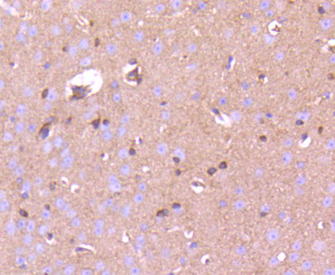 Immunohistochemical analysis of paraffin-embedded mouse brain tissue using anti-Phospho-PAK1(S144)+PAK2(S141)+PAK3(S139) antibody. The section was pre-treated using heat mediated antigen retrieval with Tris-EDTA buffer (pH 8.0-8.4) for 20 minutes.The tissues were blocked in 5% BSA for 30 minutes at room temperature, washed with ddH2O and PBS, and then probed with the primary antibody (ET1608-58, 1/50) for 30 minutes at room temperature. The detection was performed using an HRP conjugated compact polymer system. DAB was used as the chromogen. Tissues were counterstained with hematoxylin and mounted with DPX.