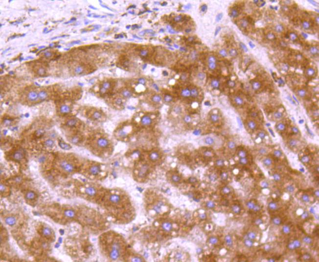 Immunohistochemical analysis of paraffin-embedded human liver tissue using anti-Calreticulin antibody. The section was pre-treated using heat mediated antigen retrieval with Tris-EDTA buffer (pH 8.0-8.4) for 20 minutes.The tissues were blocked in 5% BSA for 30 minutes at room temperature, washed with ddH2O and PBS, and then probed with the primary antibody (ET1608-60, 1/50) for 30 minutes at room temperature. The detection was performed using an HRP conjugated compact polymer system. DAB was used as the chromogen. Tissues were counterstained with hematoxylin and mounted with DPX.