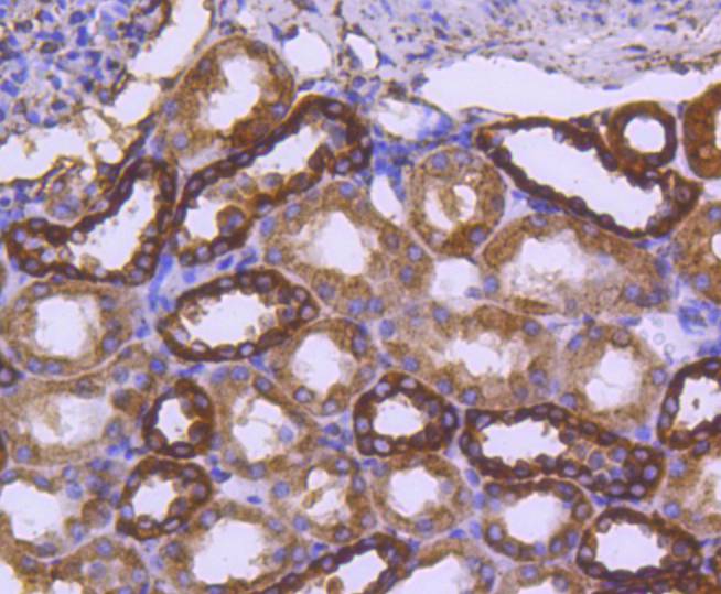 Immunohistochemical analysis of paraffin-embedded human kidney tissue using anti-Calreticulin antibody. The section was pre-treated using heat mediated antigen retrieval with Tris-EDTA buffer (pH 8.0-8.4) for 20 minutes.The tissues were blocked in 5% BSA for 30 minutes at room temperature, washed with ddH2O and PBS, and then probed with the primary antibody (ET1608-60, 1/50) for 30 minutes at room temperature. The detection was performed using an HRP conjugated compact polymer system. DAB was used as the chromogen. Tissues were counterstained with hematoxylin and mounted with DPX.