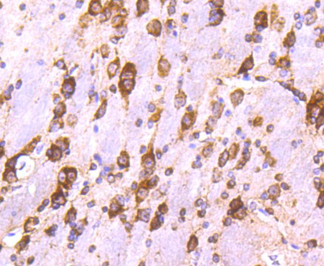 Immunohistochemical analysis of paraffin-embedded mouse brain tissue using anti-Calreticulin antibody. The section was pre-treated using heat mediated antigen retrieval with Tris-EDTA buffer (pH 8.0-8.4) for 20 minutes.The tissues were blocked in 5% BSA for 30 minutes at room temperature, washed with ddH2O and PBS, and then probed with the primary antibody (ET1608-60, 1/50) for 30 minutes at room temperature. The detection was performed using an HRP conjugated compact polymer system. DAB was used as the chromogen. Tissues were counterstained with hematoxylin and mounted with DPX.