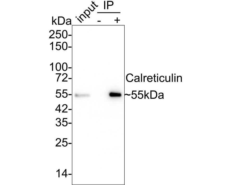 Calreticulin was immunoprecipitated in 0.2mg HeLa cell lysate with ET1608-60 at 2 µg/25 µl agarose. Western blot was performed from the immunoprecipitate using ET1608-60 at 1/1,000 dilution. Anti-Rabbit IgG for IP Nano-secondary antibody (NBI01H) at 1/5,000 dilution was used for 1 hour at room temperature.<br />
<br />
Lane 1: HeLa cell lysate (input)<br />
Lane 2: Rabbit IgG instead of ET1608-60 in HeLa cell lysate<br />
Lane 3: ET1608-60 IP in HeLa cell lysate<br />
<br />
Blocking/Dilution buffer: 5% NFDM/TBST<br />
Exposure time: 24 seconds