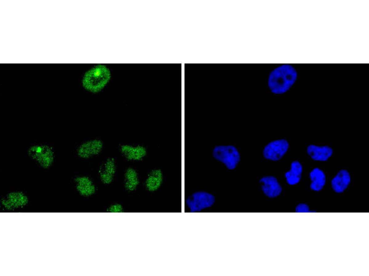 ICC staining of p27 KIP 1 in A431 cells (green). Formalin fixed cells were permeabilized with 0.1% Triton X-100 in TBS for 10 minutes at room temperature and blocked with 1% Blocker BSA for 15 minutes at room temperature. Cells were probed with the primary antibody (ET1608-61, 1/50) for 1 hour at room temperature, washed with PBS. Alexa Fluor®488 Goat anti-Rabbit IgG was used as the secondary antibody at 1/1,000 dilution. The nuclear counter stain is DAPI (blue).