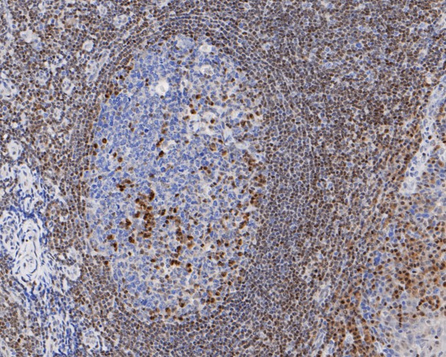 Immunohistochemical analysis of paraffin-embedded human tonsil tissue using anti-p27 KIP 1 antibody. The section was pre-treated using heat mediated antigen retrieval with sodium citrate buffer (pH 6.0) for 20 minutes. The tissues were blocked in 5% BSA for 30 minutes at room temperature, washed with ddH2O and PBS, and then probed with the primary antibody (ET1608-61, 1/200)  for 30 minutes at room temperature. The detection was performed using an HRP conjugated compact polymer system. DAB was used as the chromogen. Tissues were counterstained with hematoxylin and mounted with DPX.