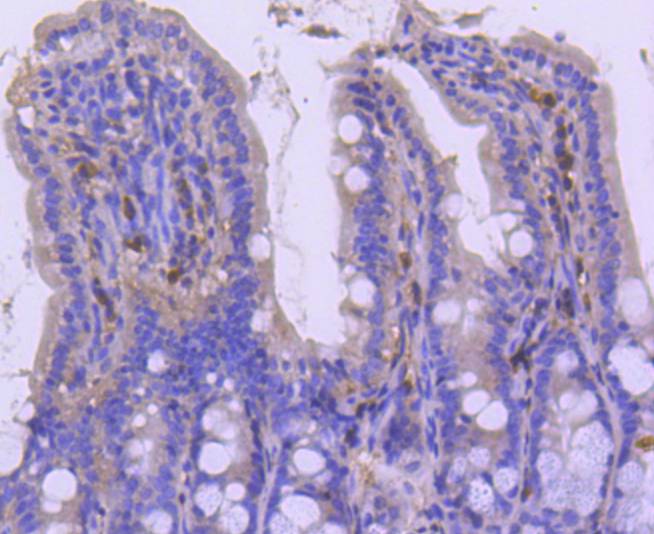 Immunohistochemical analysis of paraffin-embedded mouse colon tissue using anti-p27 KIP 1 antibody. The section was pre-treated using heat mediated antigen retrieval with sodium citrate buffer (pH 6.0) for 20 minutes. The tissues were blocked in 5% BSA for 30 minutes at room temperature, washed with ddH2O and PBS, and then probed with the primary antibody (ET1608-61, 1/50)  for 30 minutes at room temperature. The detection was performed using an HRP conjugated compact polymer system. DAB was used as the chromogen. Tissues were counterstained with hematoxylin and mounted with DPX.
