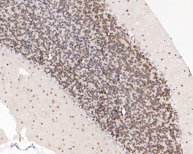 Immunohistochemical analysis of paraffin-embedded mouse cerebellum tissue using anti-p27 KIP 1 antibody. The section was pre-treated using heat mediated antigen retrieval with sodium citrate buffer (pH 6.0) for 20 minutes. The tissues were blocked in 5% BSA for 30 minutes at room temperature, washed with ddH2O and PBS, and then probed with the primary antibody (ET1608-61, 1/200)  for 30 minutes at room temperature. The detection was performed using an HRP conjugated compact polymer system. DAB was used as the chromogen. Tissues were counterstained with hematoxylin and mounted with DPX.