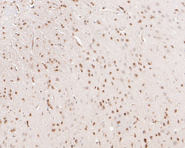Immunohistochemical analysis of paraffin-embedded rat brain tissue using anti-p27 KIP 1 antibody. The section was pre-treated using heat mediated antigen retrieval with sodium citrate buffer (pH 6.0) for 20 minutes. The tissues were blocked in 5% BSA for 30 minutes at room temperature, washed with ddH2O and PBS, and then probed with the primary antibody (ET1608-61, 1/50)  for 30 minutes at room temperature. The detection was performed using an HRP conjugated compact polymer system. DAB was used as the chromogen. Tissues were counterstained with hematoxylin and mounted with DPX.
