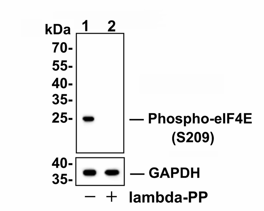 Western blot analysis of Phospho-eIF4E (S209) on NIH-3T3 cell lysates.<br />
<br />
Lane 1: NIH-3T3 cells, whole cell lysate, 10 μg /lane.<br />
Lane 2: NIH-3T3 cells were treated with 2.8μg/ul lambda-PP for 30 minutes, whole cell lysates, 10 μg/lane.<br />
<br />
Proteins were transferred to a PVDF membrane and blocked with 5% BSA in PBS for 1 hour at room temperature. The primary antibody Anti-Phospho-eIF4E (S209) (ET1608-66, 1/500) and Anti-GAPDH antibody (ET1601-4, 1/10,000)was used in 5% BSA at room temperature for 2 hours. Goat Anti-Rabbit IgG H&L (HRP) Secondary Antibody (HA1001) at 1:200,000 dilution was used for 1 hour at room temperature.<br />
<br />
Predicted band size: 25 kDa<br />
Observed band size: 25 kDa<br />
Exposure time: 2 minutes 29 seconds