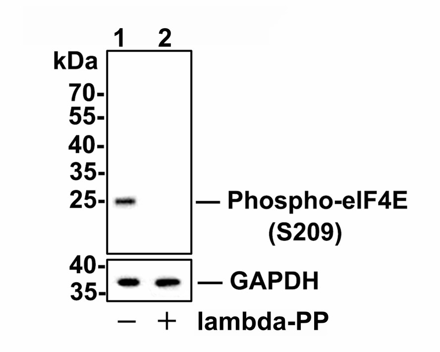 Western blot analysis of Phospho-eIF4E (S209) on rat spleen tissues lysates.<br />
<br />
Lane 1: Rat spleen tissues, whole tissue lysates, 20 μg /lane.<br />
Lane 2: Rat spleen tissues were treated with 2.8μg/ul lambda-PP for 30 minutes, whole tissue lysates, 20 μg/lane.<br />
<br />
Proteins were transferred to a PVDF membrane and blocked with 5% BSA in PBS for 1 hour at room temperature. The primary antibody Anti-Phospho-eIF4E (S209) (ET1608-66, 1/500) and Anti-GAPDH antibody (ET1601-4, 1/10,000)was used in 5% BSA at room temperature for 2 hours. Goat Anti-Rabbit IgG H&L (HRP) Secondary Antibody (HA1001) at 1:200,000 dilution was used for 1 hour at room temperature.<br />
<br />
Predicted band size: 25 kDa<br />
Observed band size: 25 kDa<br />
Exposure time: 3 seconds